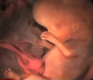 L’enfant à la douzième semaine de grossesse, délai légal pour avorter sur simple demande en France. Capture d’écran du film « De la conception à la naissance ».