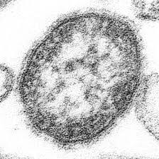 Rougeole : “Une épidémie est possible”, affirme un spécialiste