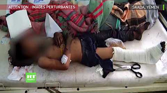 Yémen : au moins 29 enfants tués dans une attaque contre un bus (images choquantes)