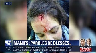 “Il faut qu’ils aient conscience de ce qu’ils font.” Blessés par des tirs de LBD, ces Gilets Jaunes témoignent (VIDÉO)