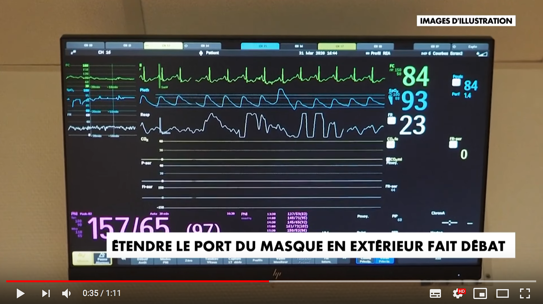Le port du masque à l’extérieur fait débat… chez les médecins